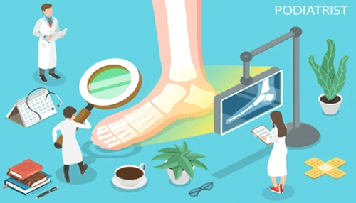When Should You See A Podiatrist
